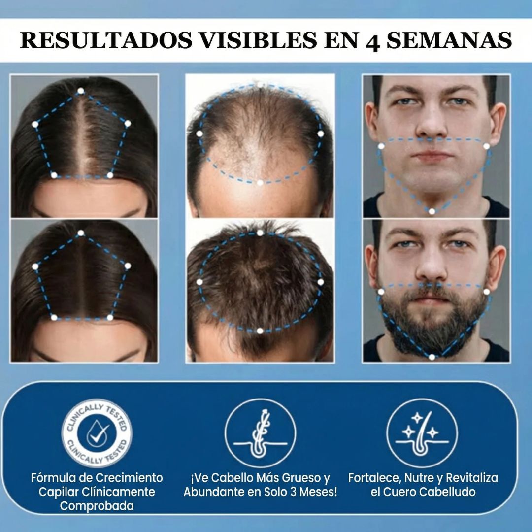 HairWise® Serum Roll-On - Crecimiento y Fortalecimiento capilar