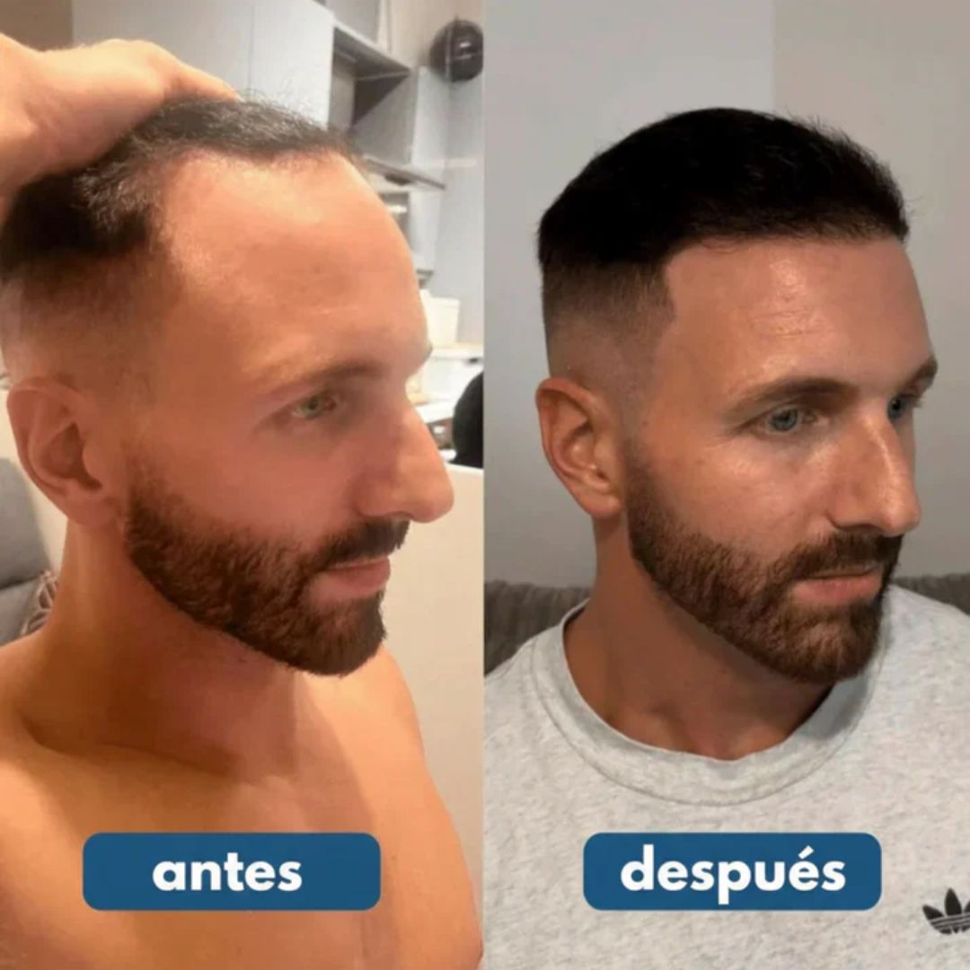 HairWise® Serum Roll-On - Crecimiento y Fortalecimiento capilar