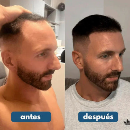 HairWise® Serum Roll-On - Crecimiento y Fortalecimiento capilar